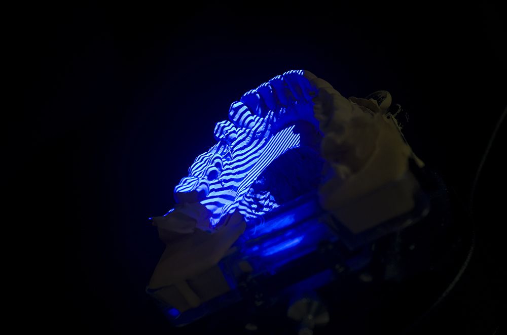 Digitaler Scan eines Zahnmodells